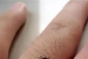 灭绝蚊子的有效方法（保护健康，消灭蚊虫威胁）