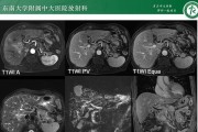 LGG4系统的功能与性能评测（探索LGG4系统的卓越表现与全新特性）